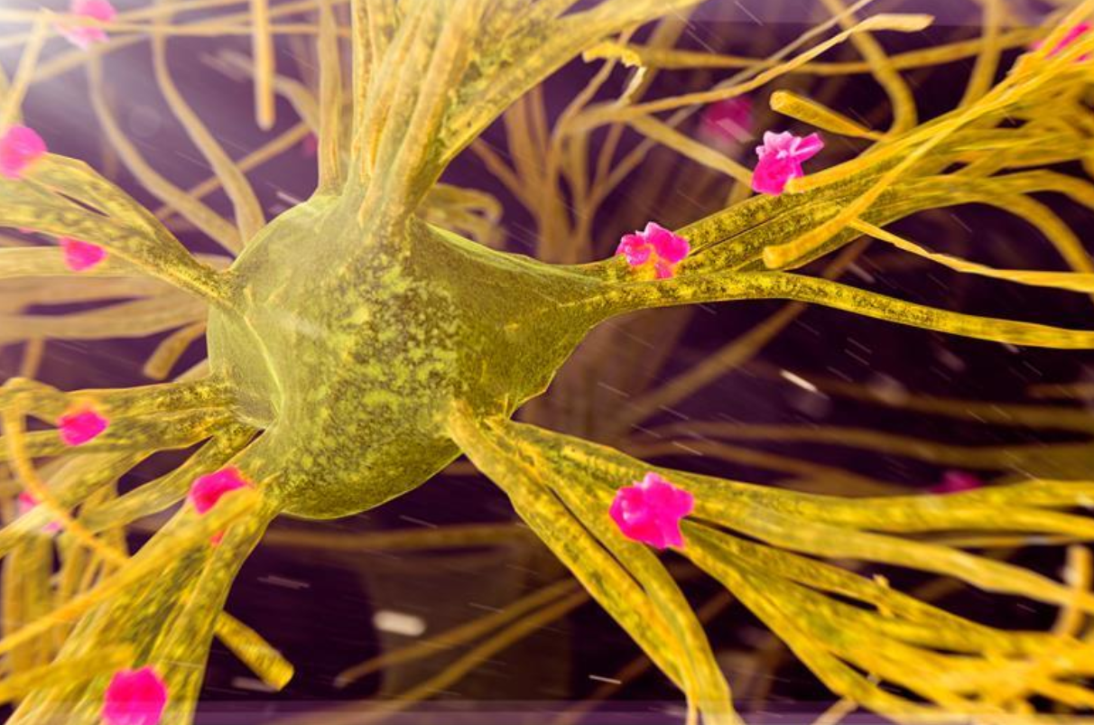Could Low Lithium in the Brain Be the Hidden Trigger Behind Alzheimer’s?